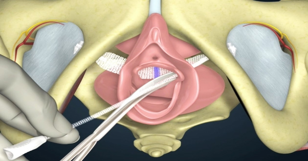 Courses Images